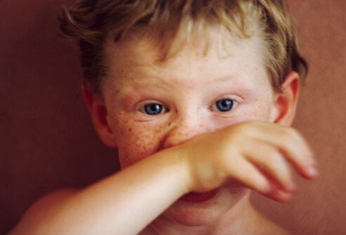 Photo of boy wiping nose.