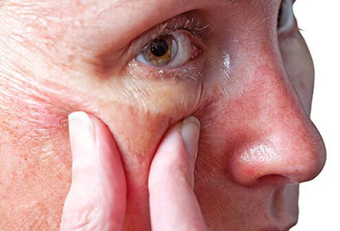 Overdoing chemical peels or microdermabrasion may do more harm than good.