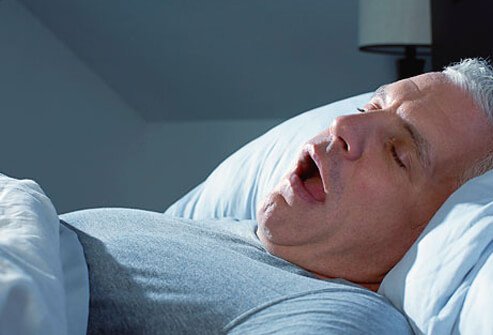 Picture of a Man with Fatigue Caused By Sleep Apnea