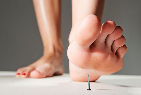Another summer travel safety tip is to watch your step!