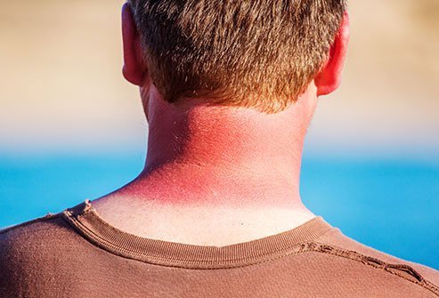 Seek the shade, wear sunscreen, wear long sleeves and long pants, and avoid midday sun to practice sun safety.