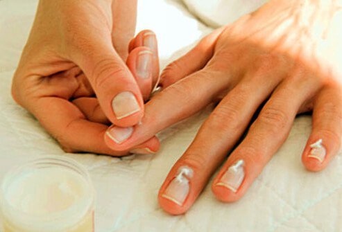 If your hands are often in water -- especially if you use strong soap -- your nails may split, peel, or become brittle.