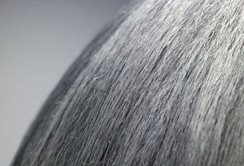 If you are under 40 and more than half of your hair is white, you're 