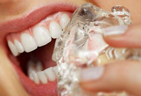 Ice chewing can cause permanent damage to your teeth.