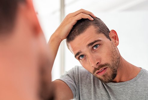 balding and hair loss
