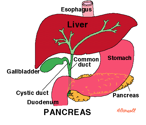 Pancreas Illustration - Chronic pancreatitis