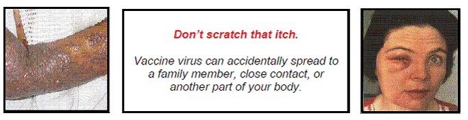 Do not scratch that itch - Illustration