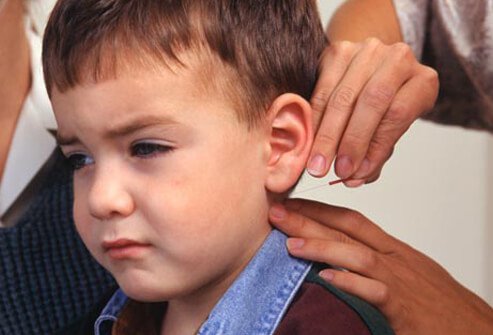 Acupuncture is generally believed to be safe for children.