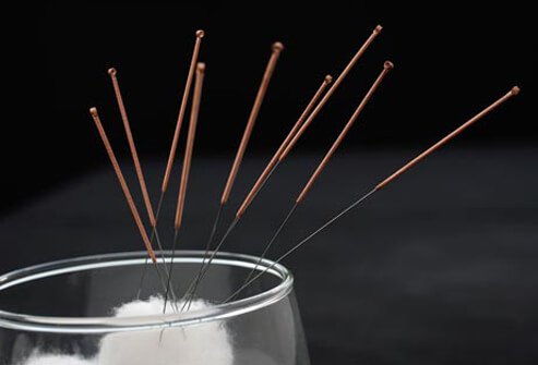 The needles used for acupuncture are quite fine and most people feel little or no pain.