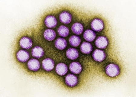 Picture of colorized transmission electron micrograph of adenovirus