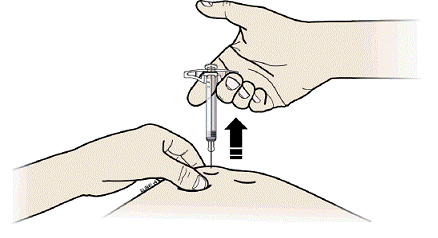 Pinch the skin firmly between your thumb and fingers, creating an area about two inches wide - Illustration