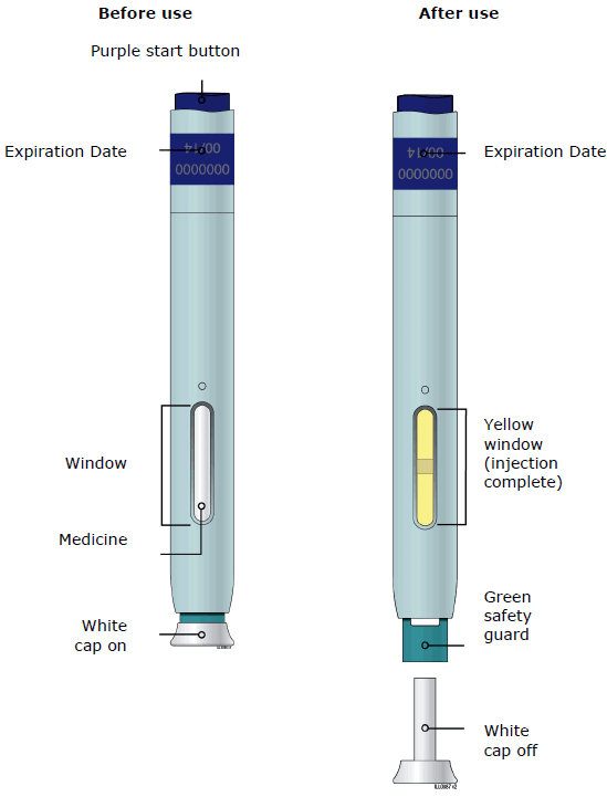 Single-Dose Prefilled Syringe - Before use - Illustration