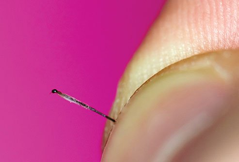 Gray hair grows from hair shafts that no longer contain pigment-producing cells.