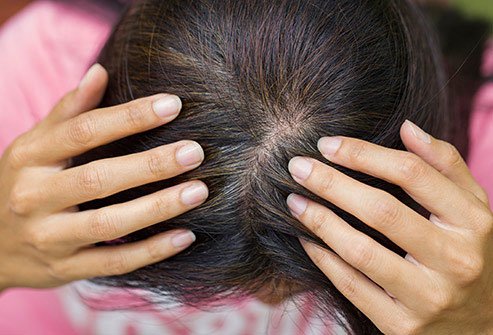 Premature gray hair occurs 10 or more years earlier than it should.