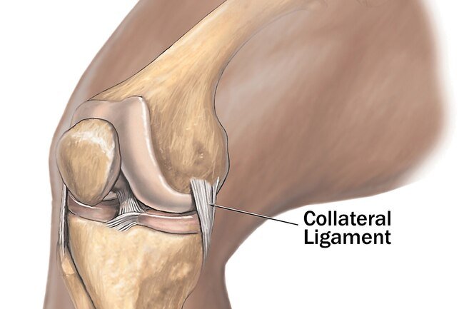 You'll have pain and swelling. The joint may feel weak or unstable.