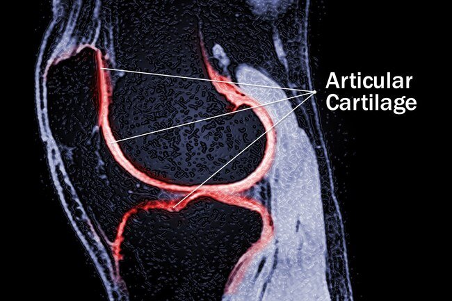 This slippery stuff covers the ends of your thigh and shin bones.
