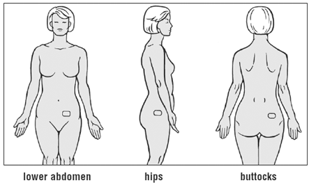 Choose a skin area to apply the patch - Illustration