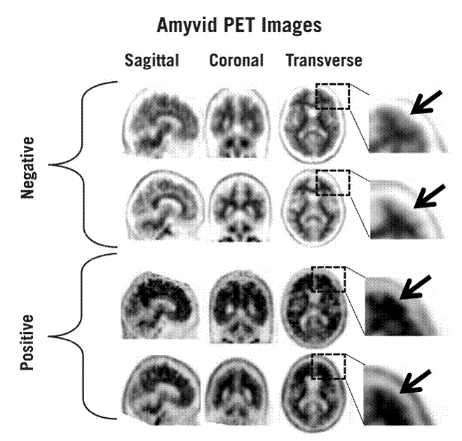 Examples of negative and positive scans - Illustration