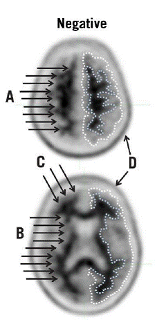 Examples of negative scans - Illustration