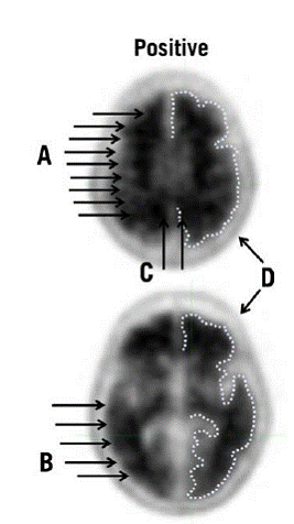 Examples of positive scans - Illustration