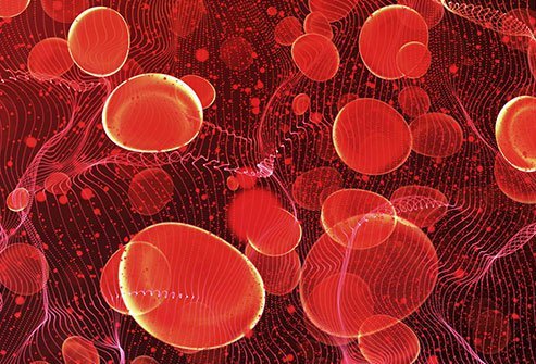 Anemia is a condition in which a person has a problem making or keeping healthy red blood cells. Anemia is treated with iron or vitamin supplements or a stem cell or blood transfusion. 