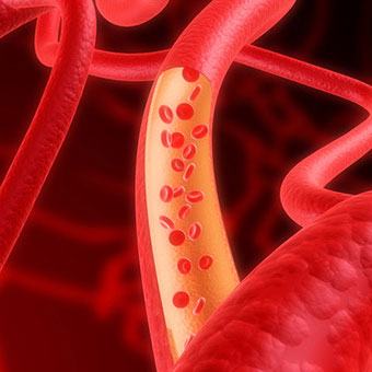 Image illustrating red blood cells within human arteries.