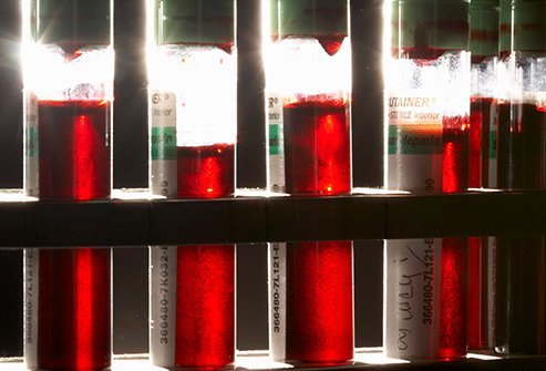 A complete blood count helps diagnose blood illnesses.