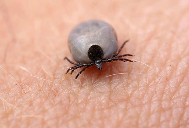 What Home Remedy Kills Ticks