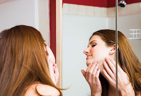 Photo of a woman treating an ingrown hair.