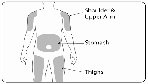 Application areas -  Illustration