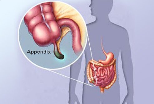 Your appendix is a small, pouch-like sac of tissue at the beginning of your large intestine.