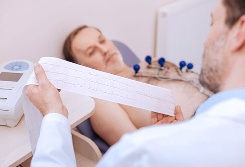 Untreated arrhythmia in some individuals may increase the risk of stroke, heart attack, dementia, and heart failure.