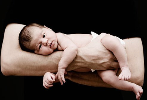 Colic in babies