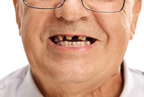 Keep your mouth clean to prevent malodorous bacteria.