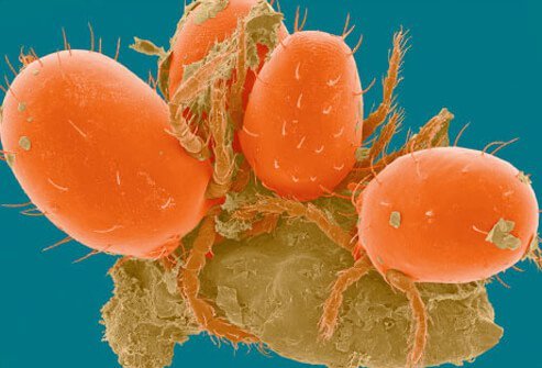 Chiggers are a type of mite from the family known as Trombiculidae.