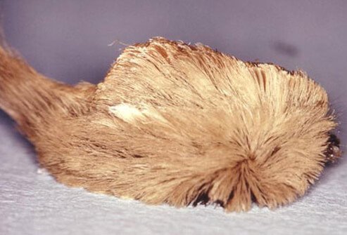 The puss caterpillar (woolly slug, or asp) is the most toxic caterpillar in the U.S.