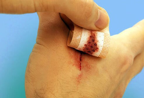 Always cover cuts and scrapes on your hands and feet to protect them from germs and dirt. 