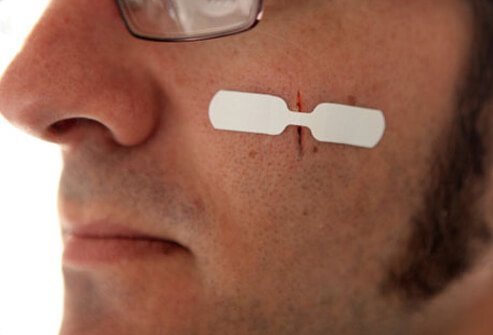 Use a butterfly bandage on a cut to help keep the sides of a wound together while it heals.