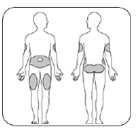 Choose your injection site - Illustration