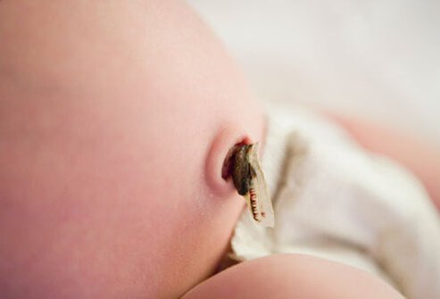 Until baby's cord falls off, avoid getting it wet.
