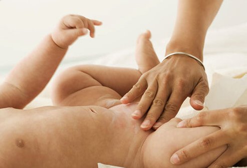 Wet and dirty diapers can irritate infant skin, causing diaper rash.
