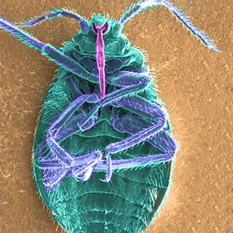 Electron micrograph (SEM) of a bedbug (Cimex lectularius).