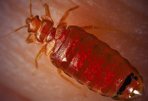 There is little evidence to suggest that bedbugs spread any human diseases with their bites.