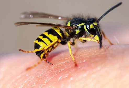 Wash a yellow jacket sting with soap and warm water and then use home remedies to relieve pain and swelling.