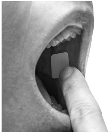 Using a finger, place the yellow side of the BELBUCA
buccal film against the inside of your moistened cheek - Illustration