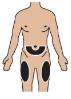  Choose and clean injection site - Illustration