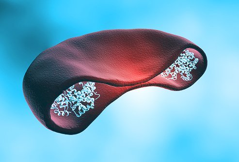 People with thalassemia make defective hemoglobin, the compound in blood that carries oxygen.