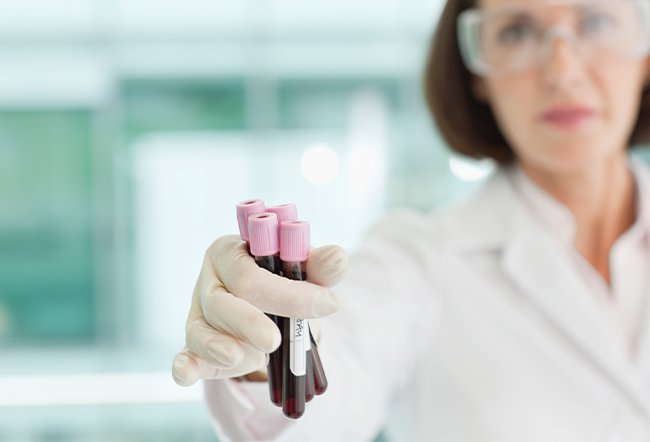 Factor 5 Leiden test