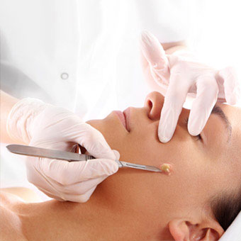 A health-care professional lances a boil on a woman's face.