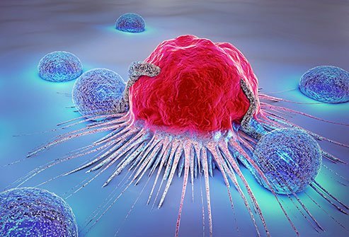 Bone cancer is also referred to as the sarcoma of bone. If it is in the leg, it may feel painful in the area where the tumor is located.